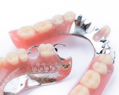 Partial denture upper side on a white background